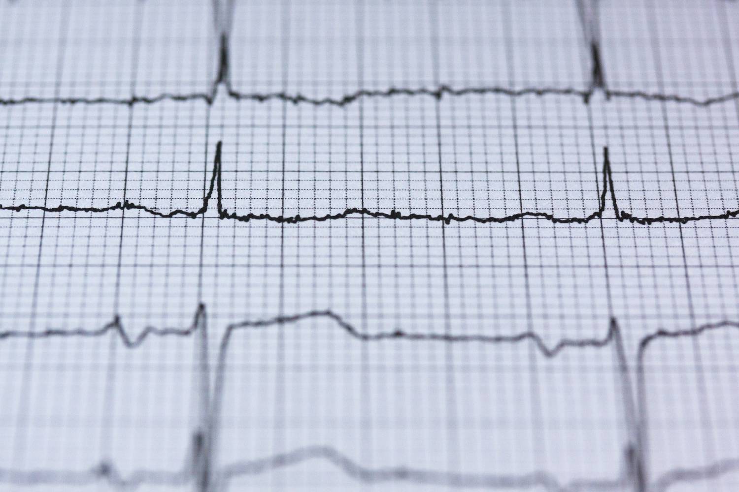 Ecg 2270728 1920 1