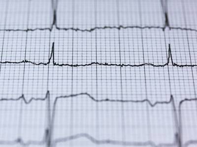 Thumb ecg 2270728 1920 1