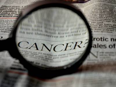 Thumb cancer 389921 1920 1