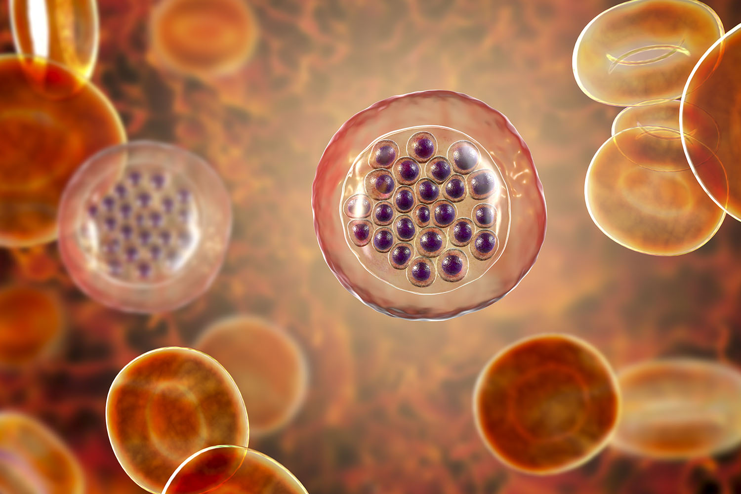 Malaria plasodium falciparum