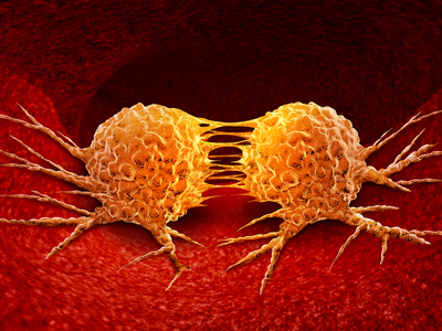 Thumb cellule tumorali tumori